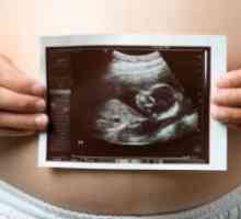 21 Недели од бременоста - феталната големина