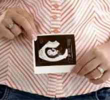 6 Недели од бременоста - феталниот развој