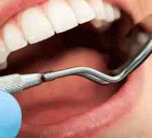 Уста болест - третман