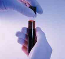 Тест на крвта за бременост