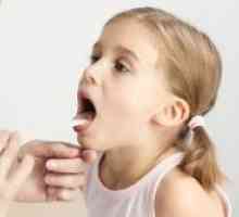 Болки во грлото кај децата - симптоми