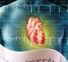 Срцева аритмија - третман
