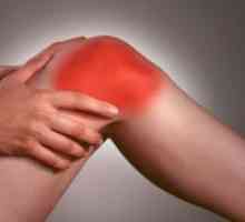 Остеоартритис на коленото заеднички Степен 3 - Третман