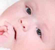 Атопичен дерматитис кај бебињата - Третман