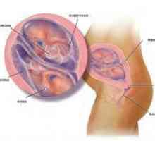 Бременост со близнаци - знаци