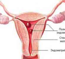 Бременост и ендометријален полип