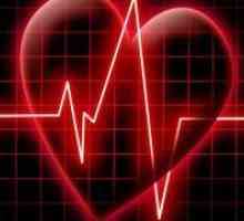 Опасните синус аритмија на срцето?