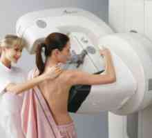 Дигитална мамографија