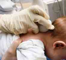 Зошто мозокот ултразвук бебе