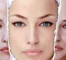 Што е ласерски resurfacing на лицето и на придобивките од користењето