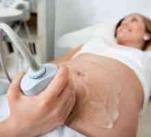 Доплер ултразвук во бременоста - што е тоа?