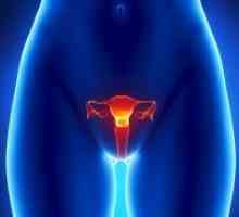 Матката fibroids - Симптоми