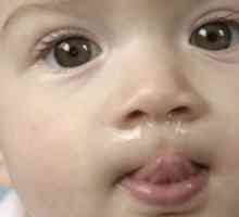 Физиолошки течење на носот кај доенчиња