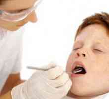 Запечатување на забите кај децата