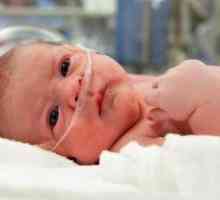 Хипоксија кај новороденчиња - што е тоа?