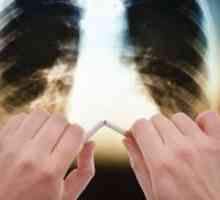 COPD - животен век