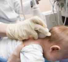 Церебрална исхемија кај новороденчињата