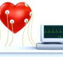 Електрокардиограм срцето - препис