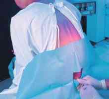Епидуралната анестезија за време на породувањето