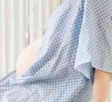 Епидуралната анестезија за време на породувањето