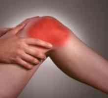 Како да се третираат остеоартритис на коленото?