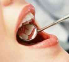 Како да се третираат забите?