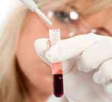 Како да се утврди крвна група?