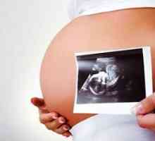 Како да се идентификуваат Даунов синдром во бременоста