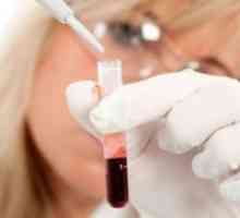 Како да се подигне на белите крвни клетки по хемотерапија?