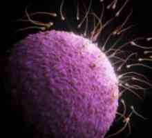 Како да се зголеми подвижноста на сперматозоидите?