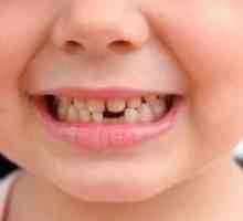Кои се заби падне кај децата?