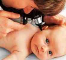 Catarrhal воспаление на средното уво кај децата - Третман