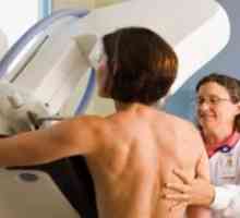 Кога е најдобро да се направи мамограм?