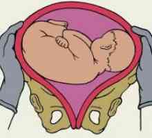 Кос позиција на фетусот