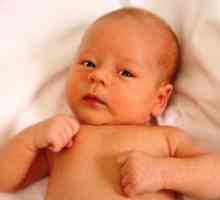 Тортиколис кај дете 3 месеци - Симптомите