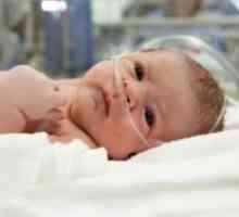 Церебрална хеморагија кај новороденчињата