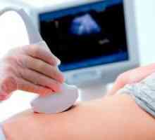 Лапароскопија матката fibroids