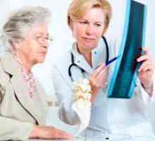 Третман на остеопороза кај постарите жени