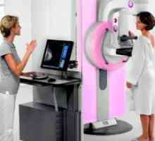 Мамографија - кога да се направи?
