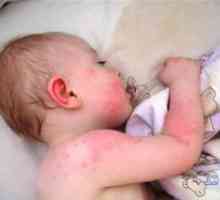 Маст од алергии за деца
