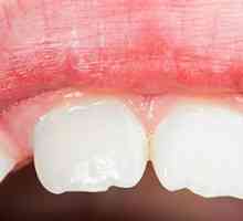 Млечните заби кај децата