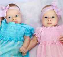 Monoamniotic monochorionic близнаци