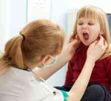 Мононуклеоза кај децата - Третман