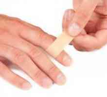 Апсцес на прстот - Третман