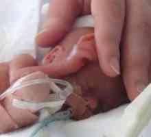 Предвремено родени бебиња - развој