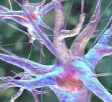 Невритис на sciatic нерв