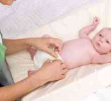 Omphalitis кај новороденчињата