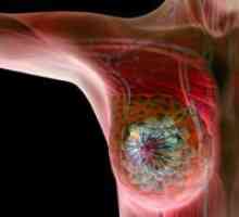 Исхрана на ракот на дојката