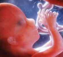 Фетус на 12 недели