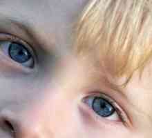 Зошто боли очите на дете